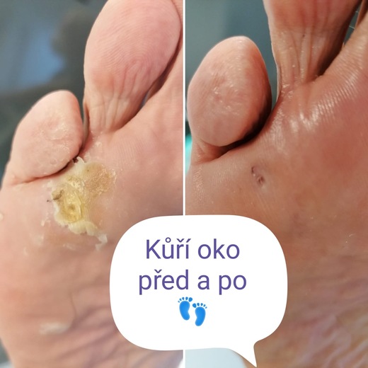 pedi_naboso_prace_25_01