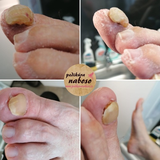 pedi_naboso_prace_25_02