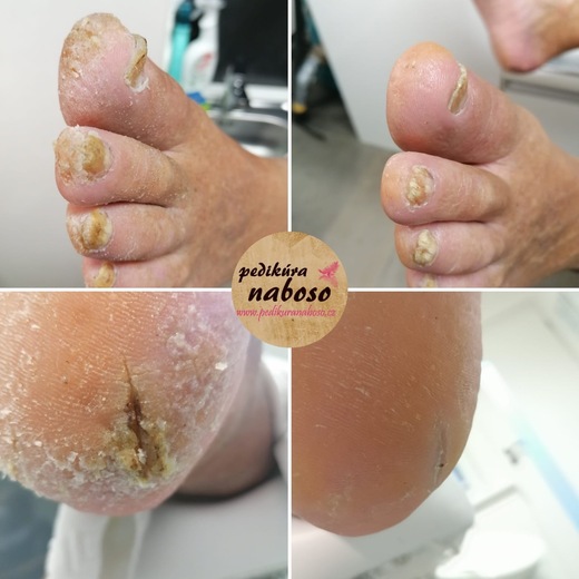 pedi_naboso_prace_25_03
