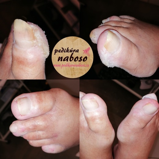 pedi_naboso_prace_25_04