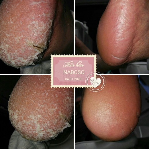 pedi_naboso_prace_25_13
