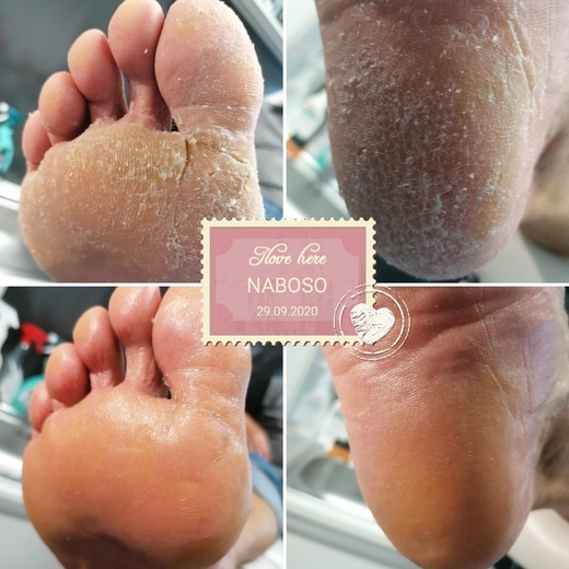 pedi_naboso_prace_25_14